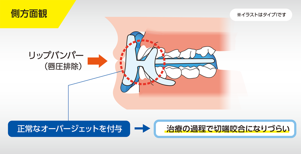 バクシネーターメカニズム